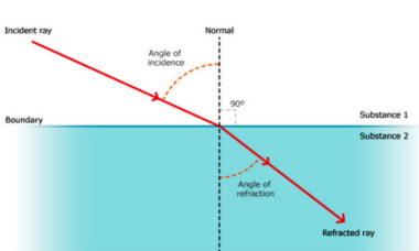 Myopia (Nearsightedness) – Types | Symptoms | Correction - Eyetrraction