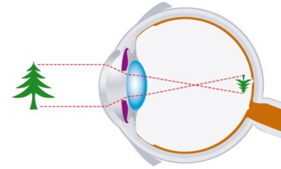 Vision_Mechanism